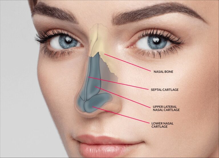 A Natural Look With Nose Surgery: Things You Need To Know