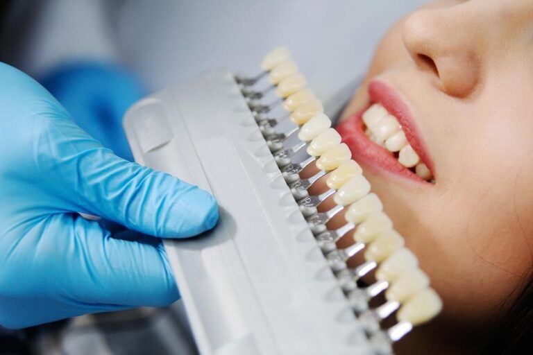  How Can Dental Crowns Make Teeth Stronger And Stop Further Tooth Deterioration?